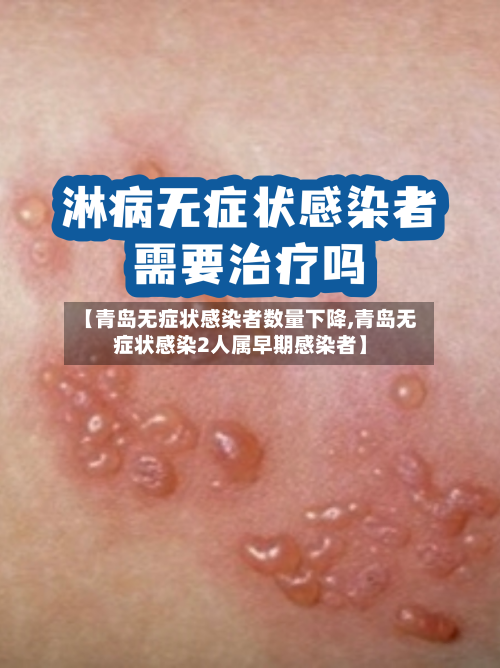【青岛无症状感染者数量下降,青岛无症状感染2人属早期感染者】